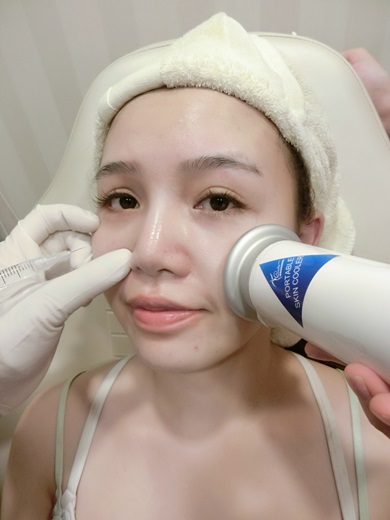 正统ulthera极线音波拉皮美国机介绍!