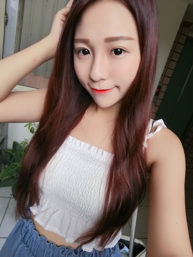 推薦花蓮 醫美診所 評價超好 玻尿酸和肉毒桿菌微整形效果很厲害 Beautytoday美麗線上 台灣