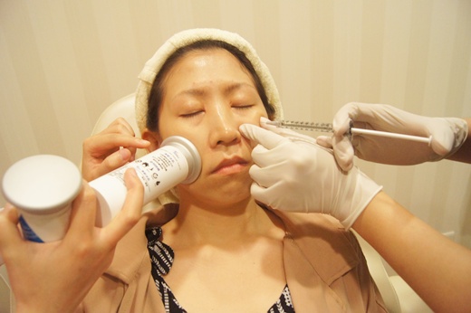 中坜【整形外科】分享:极限音波拉皮美国机与韩国机比较/舒颜萃