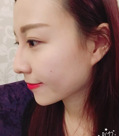基隆醫美推薦