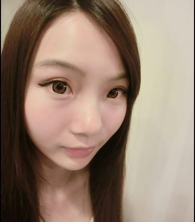 音波拉皮美國機