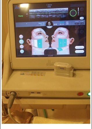 基隆拉皮