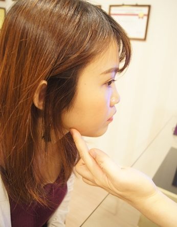 基隆醫美推薦