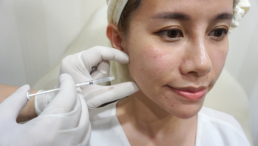 肉毒菌注射 肉毒菌注射