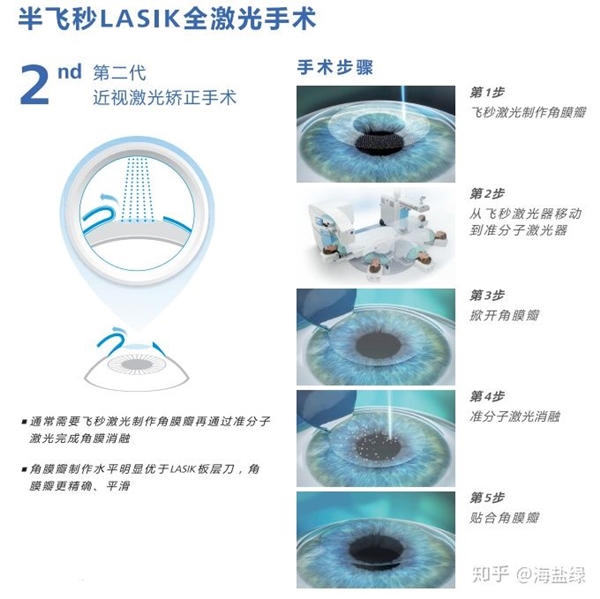 高雄近視雷射
