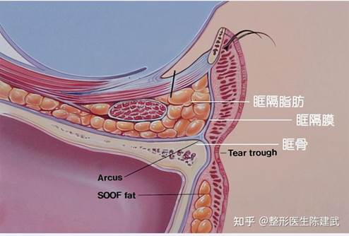 台中眼袋