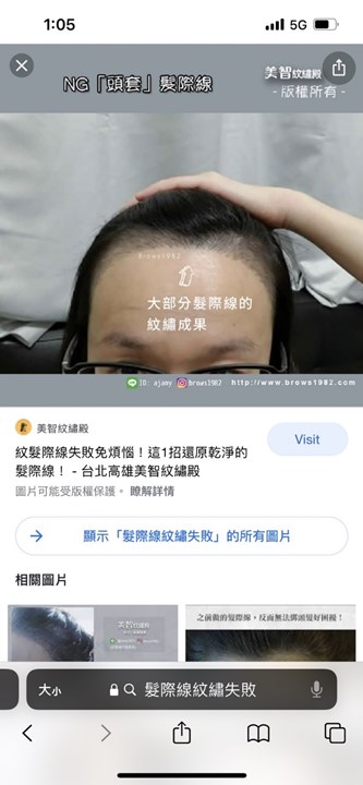 新北頭皮紋髮-版權所有(樂比美學) 新北髮際線推薦-版權所有(樂比美學)