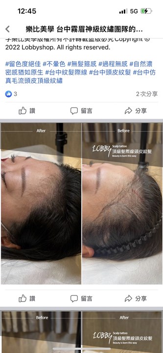 新北髮際線推薦-版權所有(樂比美學) 新北髮際線推薦-版權所有(樂比美學)