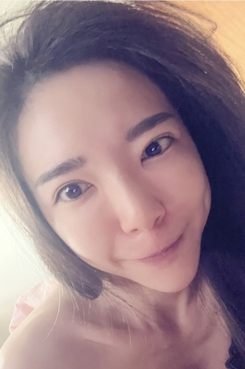 台中除毛推薦-媄婧診所